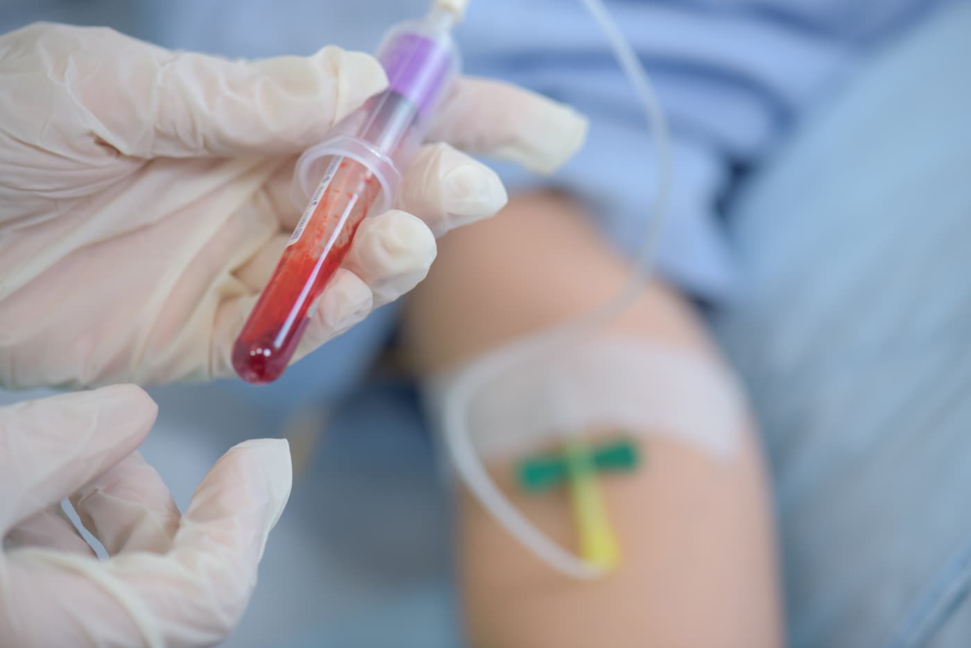 Εξετάσεις Αίματος: Όλα όσα πρέπει να γνωρίζετε και ο Γιατρός σας δεν θα σας πει